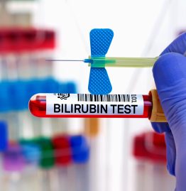 What Is a Dangerous Level of Bilirubin in Adults