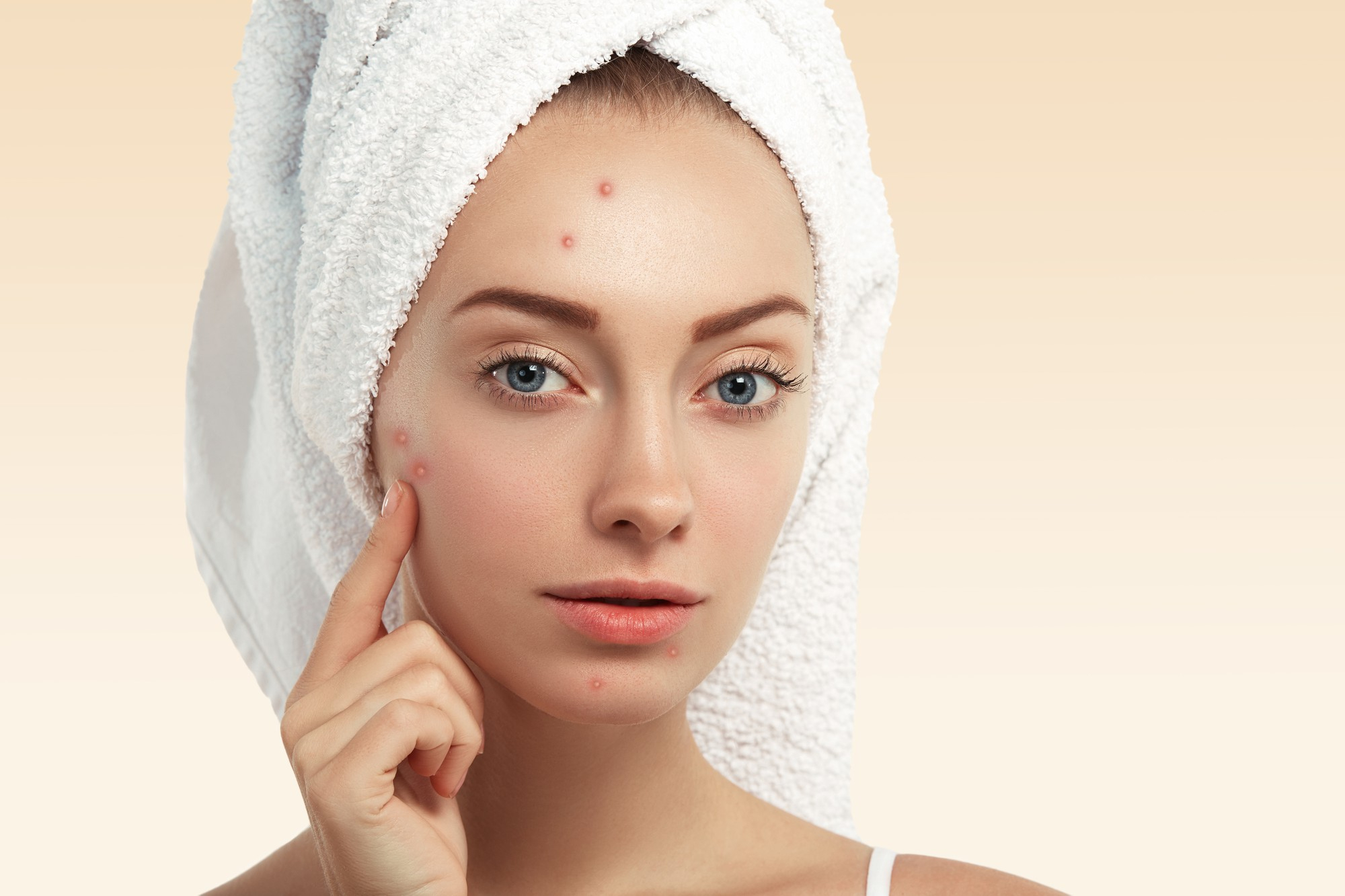 How to Remove Pimples: Your Complete Guide to Clear, Healthy Skin